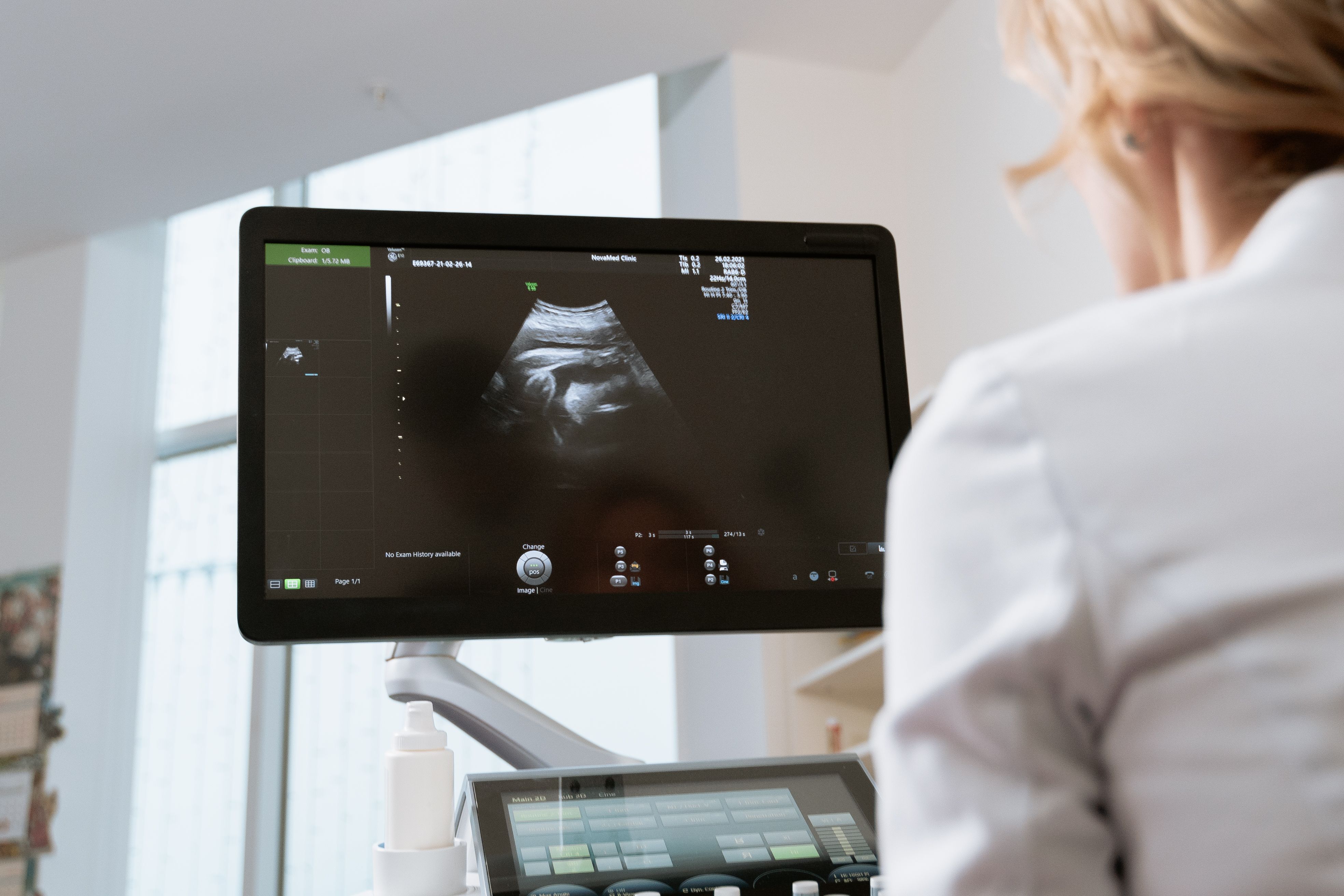 OB-GYN reviewing ultrasound imaging on a clinical monitor
